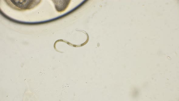 The Nematode Worm 