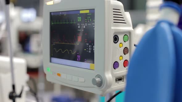 Heart beat of a patient on the screen of computers during operation in the hospital.