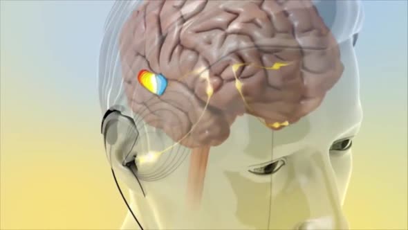3D Animated representation of the functioning of brain auditory signals