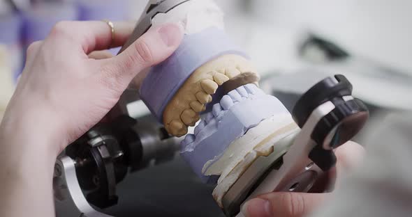 A female dentist technologist holds a mock-up of a jaw in her hands. Making dentures