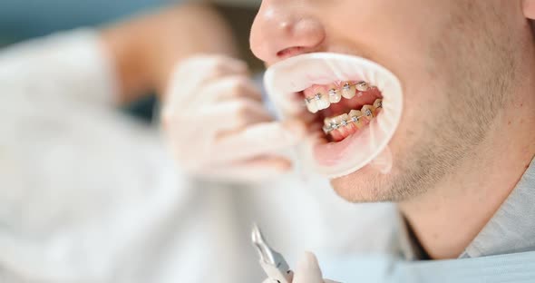 Dentist and Patient During an Orthodontic Treatment