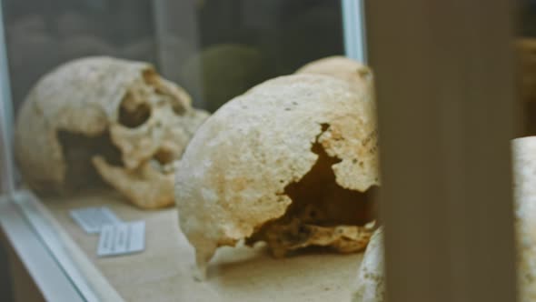 Human Skull in a Showcase