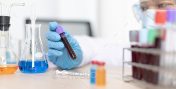he blood of infected patients in order to analyze antibiotics for normal treatment, Testing antiretroviral drugs or pathogens concept.
