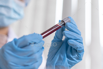 he blood of infected patients in order to analyze antibiotics for normal treatment, Testing antiretroviral drugs or pathogens concept.
