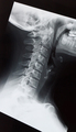 Medical X ray of a female neck, jaw and spine - PhotoDune Item for Sale