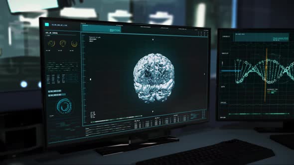 Medical Scan Of Brain Displayed In Medical Program On Screen At Laboratory alt