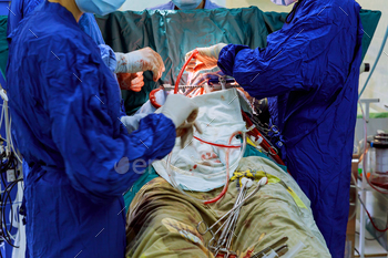 disease that are being performed in operating room hospital, coronary artery bypass grafts are being performed