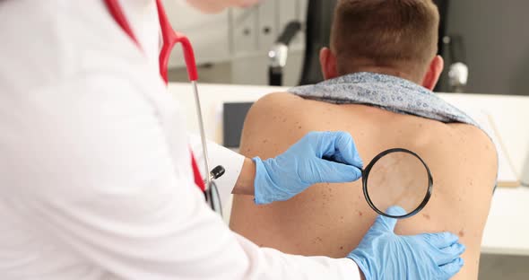 Dermatologist Examines Patient Birthmark with Magnifying Glass in Clinic  Movie