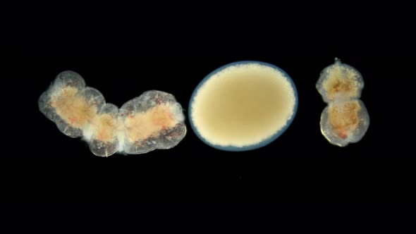 Cocoon of the Worm Tubifex Tubifex Under the Microscope