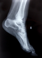 X ray of a foot and ankle - PhotoDune Item for Sale