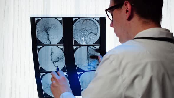 Doctor Examining Xraybrain MRI