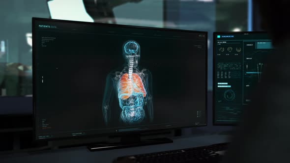 Advanced Covid-19 Virus Diagnostics With The Help Of Modern Medical Software alt