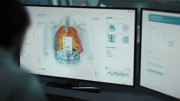 Medical Specialist Work In Modern Software To Analyze Lungs Damage From Disease alt