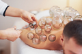 A picture of a man having cupping therapy - PhotoDune Item for Sale