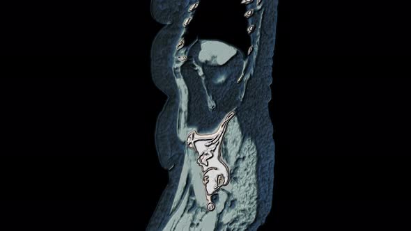Bulk Multicolored MRI of the Abdominal Cavity, Gastrointestinal Tract, Bladder