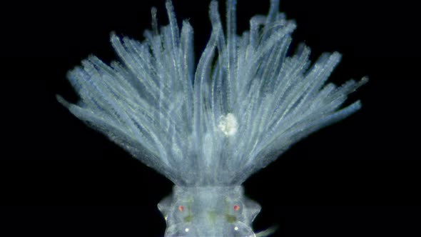 Polychaeta worm, order Sabellida under a microscope. Possibly family Fabriciidae