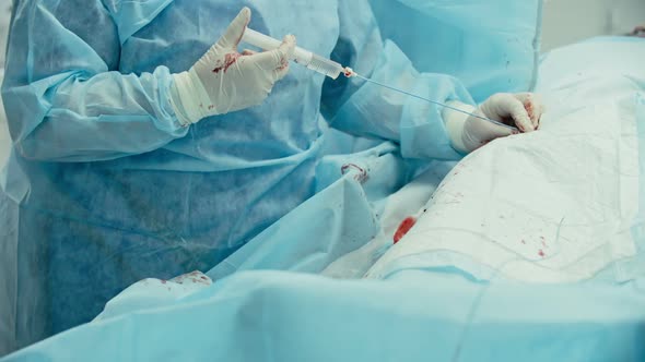 Coronary Artery Bypass Operation