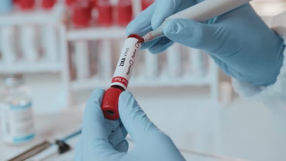 The Doctor Holds Hand Laboratory Positive Blood Test Tube for Virus Zika