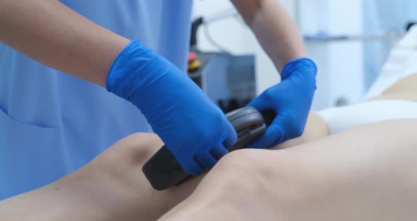 The Doctor Removes Vascular on the Legs with a Laser