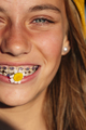 Portrait of beautiful blonde teen girl with a flower in her mouth and a bracket in her teeth. - PhotoDune Item for Sale