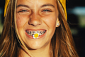 Portrait of beautiful blonde teen girl with a flower in her mouth and a bracket in her teeth. - PhotoDune Item for Sale