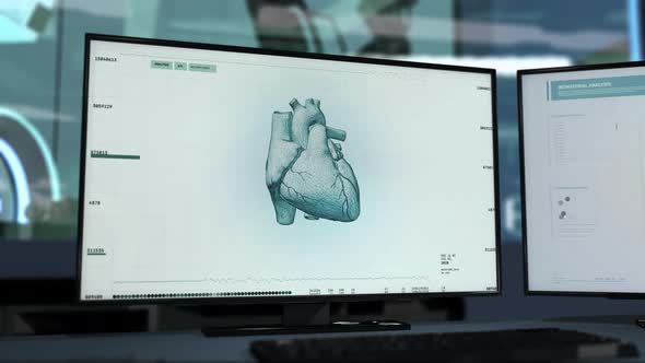 Microbiology Laboratory Interface Diagnosing Cardiac Ischemia In Patients Heart