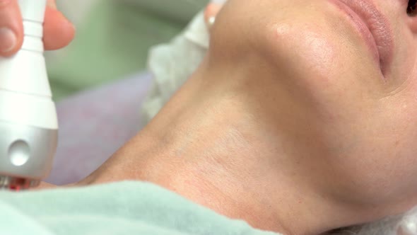 Rf Skin Tightening Neck