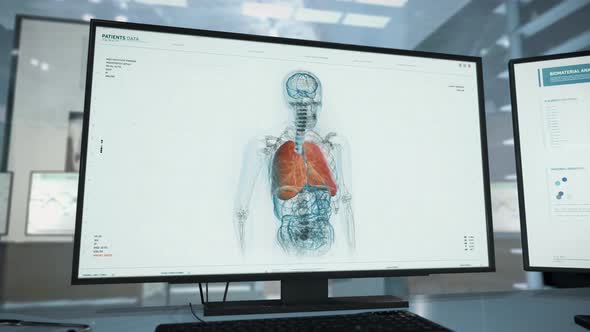 Human Body X-Rayed And Analyzed In Medical Diagnostics Software At Clinic