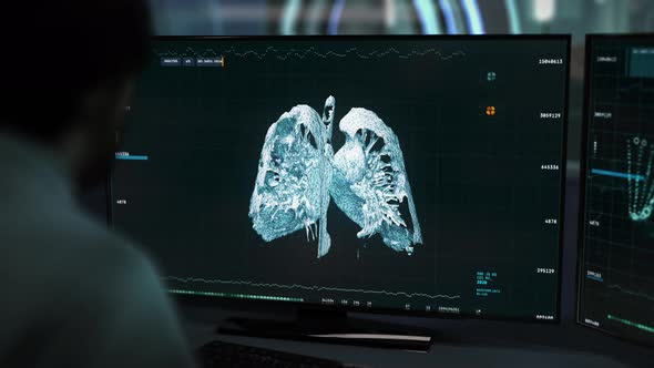 Medical analysis. Lungs on screen. Covid-19 pneumonia detected.Covid-19 symptoms alt