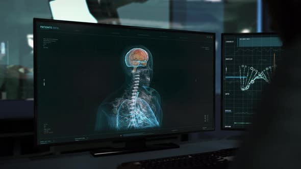 Doctors Medical Software Creates X-Ray Model Of Patients Body For Research