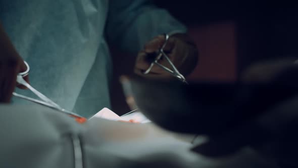 Doctor Hands Performing Operation Close Up