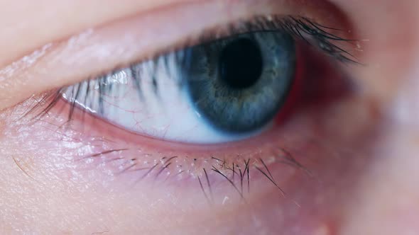 Person's Eye is Blinking in a Close Up
