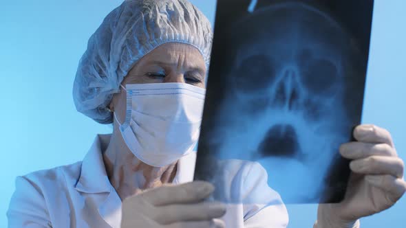 Physician Examine X-ray of the Skull