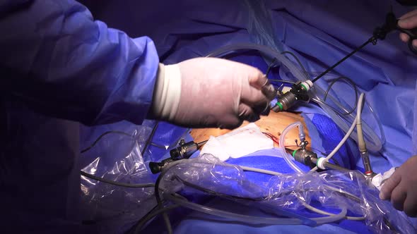 Laparoscopic Surgery 2