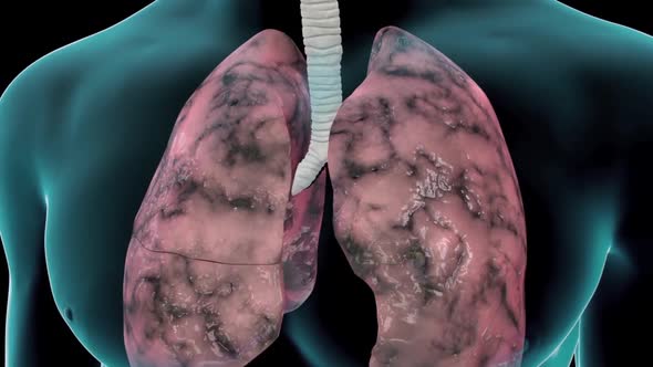 Person with damaged lungs