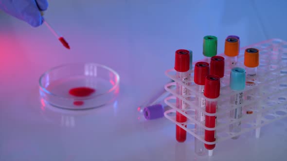 Laboratory blood tests. Scientist taking blood sample with pipette in laboratory