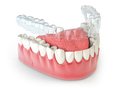 Invisalign invisible retainer  or braces with lawer jaw islated on white. - PhotoDune Item for Sale