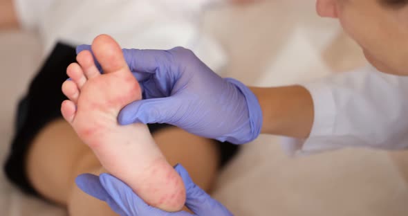 Doctor Conducts a Medical Examination and Childb Legs with Red Allergic Spots