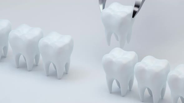 Animation of install the new tooth.