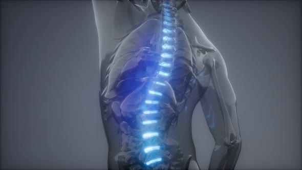 Backache in Back Bones alt