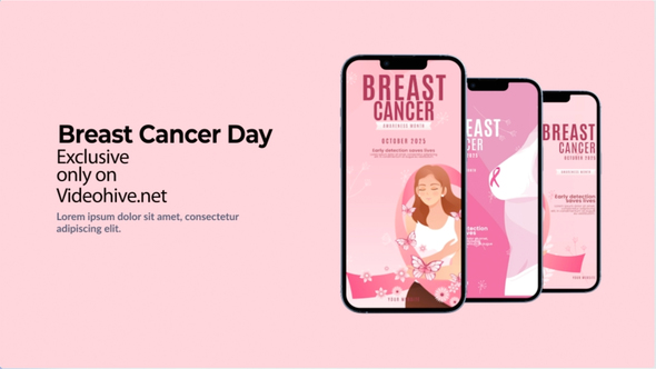 Breast Cancer Instagram Stories