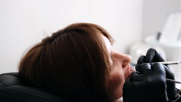 Closeup of a Young Woman with Braces Receiving Treatment in a Dental Office