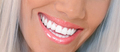 closeup of smile with white healthy teeth - PhotoDune Item for Sale