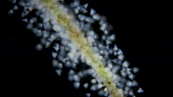 Infusoria (Ciliophora) Vorticella under microscope, class Oligohymenophorea