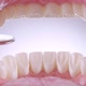 Dentist Inspects Teeth with Mirror - VideoHive Item for Sale