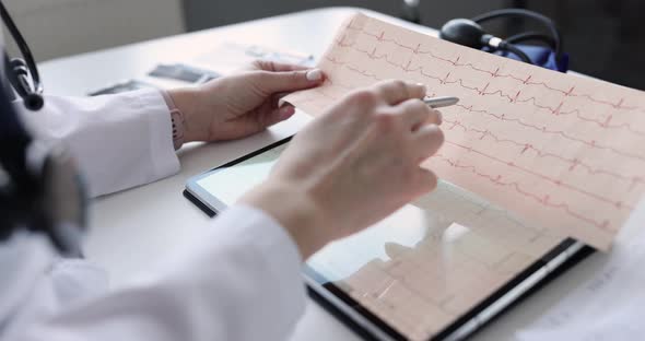 Doctor Examines an Electrocardiogram of Patient After Heart Attack