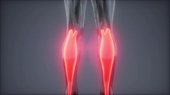 Gastrocnemius- Visible Muscle Anatomy Map alt