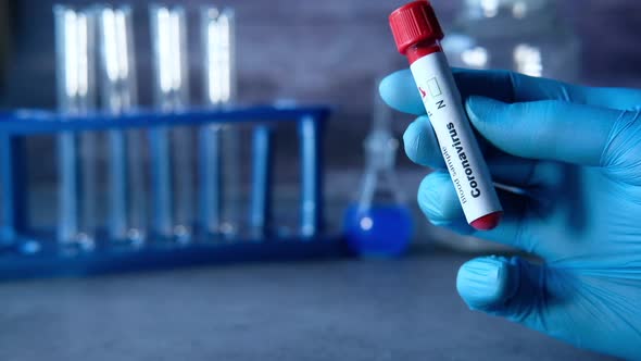 Laboratory Technician Hand Holding Blood Test Tube 