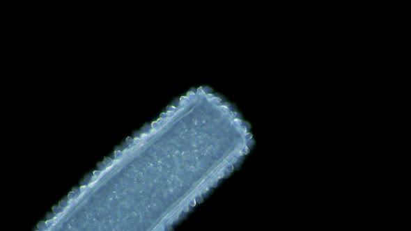 Proboscis of the worm Nemertea Prostoma sp. under a microscope