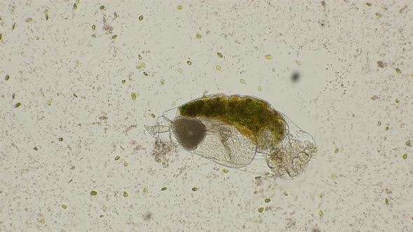 Rotifer Filters Water, and Around It I Swim the Alga Dunaliella Salina, Under a Microscope